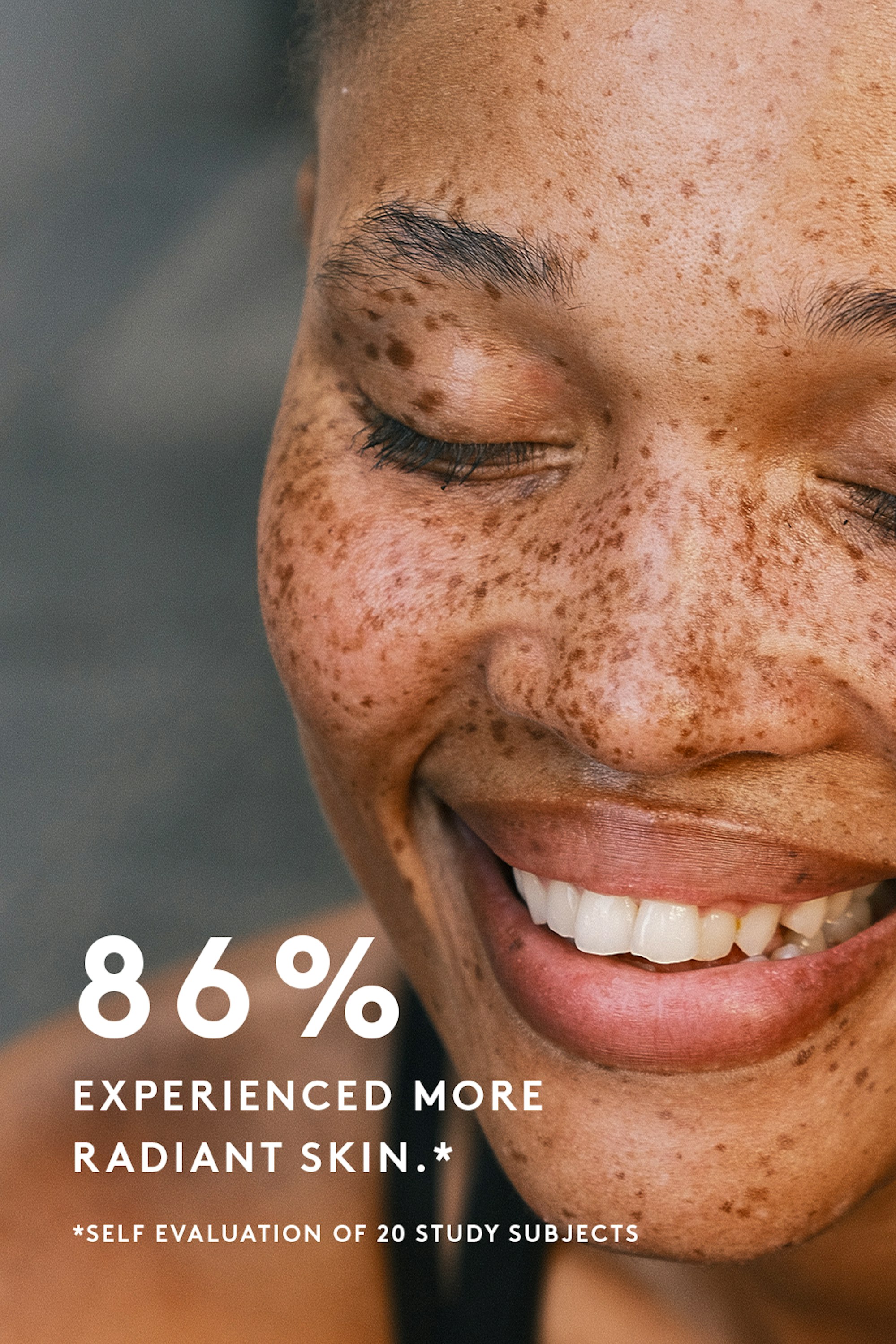 Verso-Super-C-Serum-Results